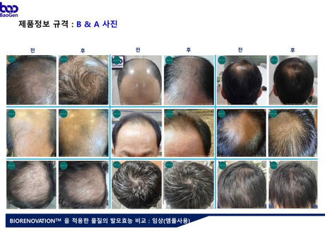 BAO H. LAB Hair Loss Care Ampoule- Siero Anticaduta Capelli, Attivatore di Crescita