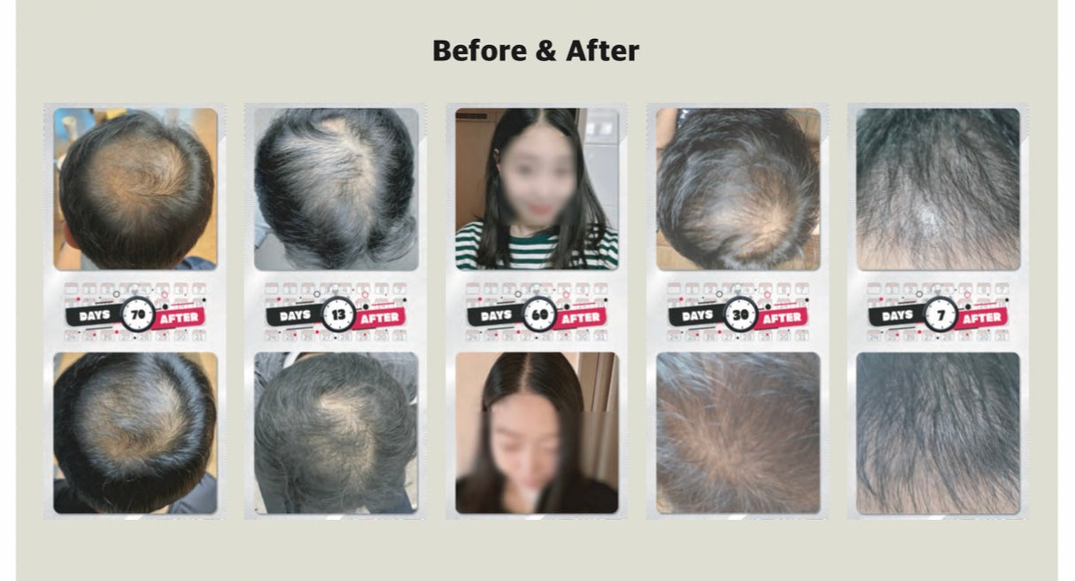 BAO H. LAB Hair Loss Care Ampoule- Siero Anticaduta Capelli, Attivatore di Crescita