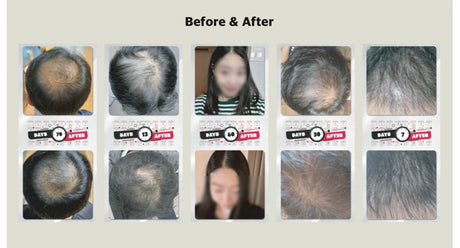 BAO H. LAB Hair Loss Care Ampoule- Siero Anticaduta Capelli, Attivatore di Crescita